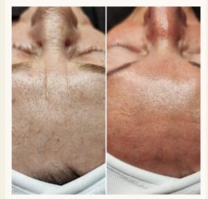 afslankpraktijk en schoonheidssalon lijfstijling